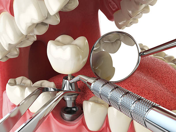 Best Weekend Emergency Dentist in Clarkston, GA