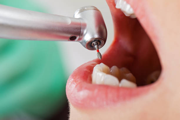 Best Same-Day Emergency Dentist in Clarkston, GA